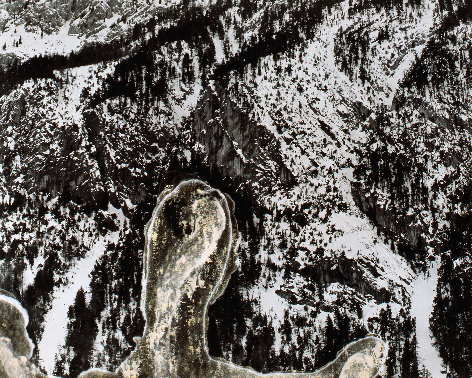 Fractures - 1993-1994