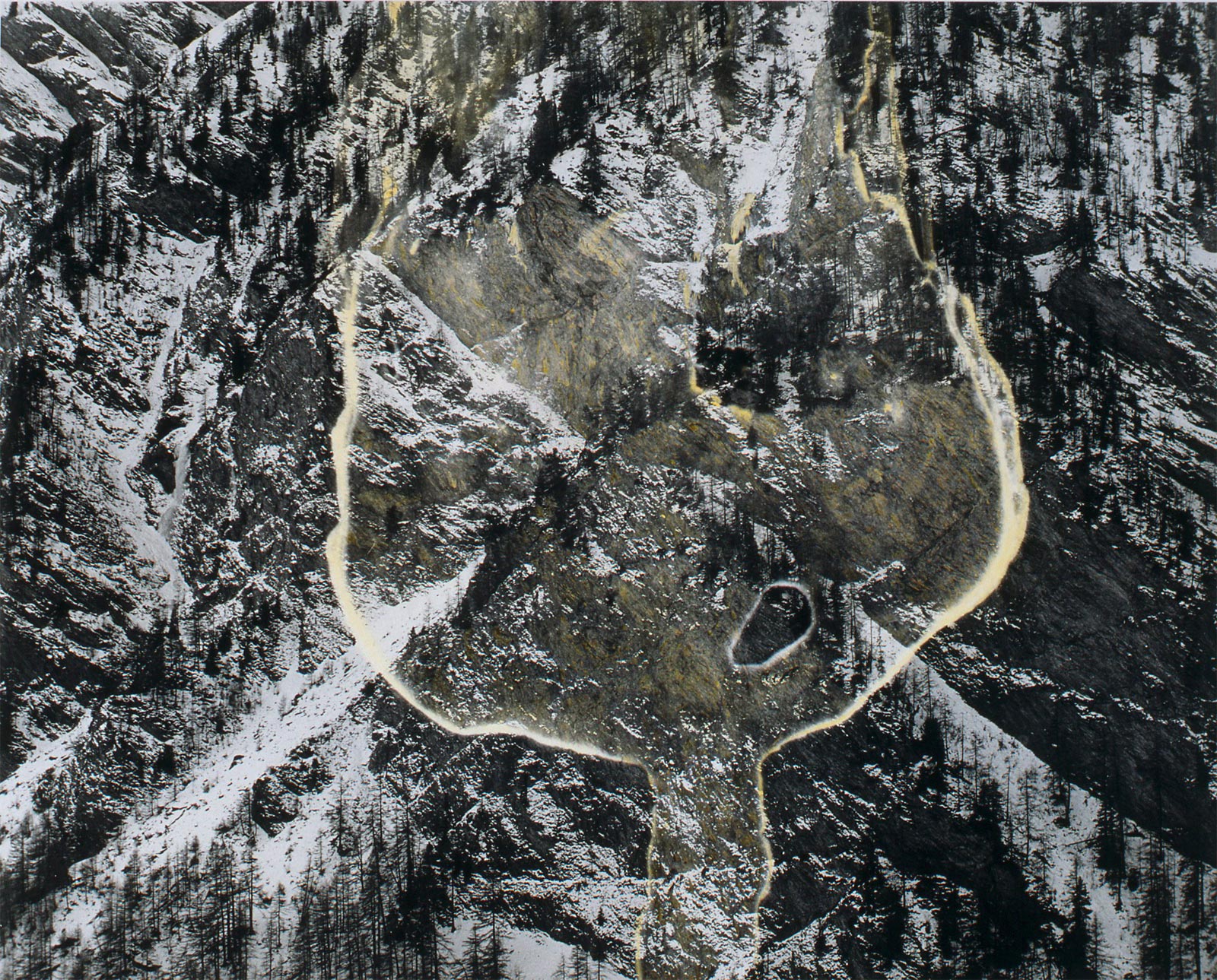 Fractures - 1993-1994